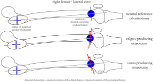derotational osteotomy of the distal
