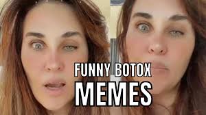 25 botox memes for long lasting laughs