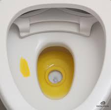 Remove Yellow Stains From Toilet Seat