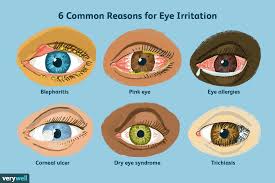 eye irritation 6 most common causes