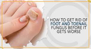 foot and toenail fungus