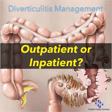 diverticulitis management outpatient