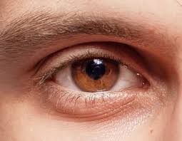 what is the rarest eye color