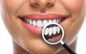unui implant dentar