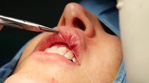 nagercoil plastic surgery