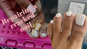 in your nail toe nail repair