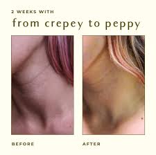 crepey skin repair treatment