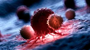 CÁNCER SOMÁTICO: UNA PERSPECTIVA DETALLADA - Lorgen