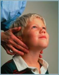 enlarged lymph nodes in children dr paul