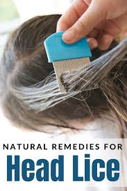 natural remes for head lice the