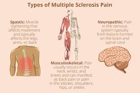 ms pain cations uses dosages