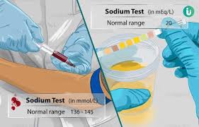 sodium test procedure purpose