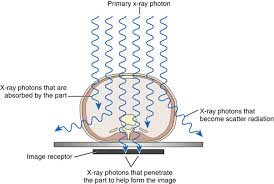 image ion radiology key