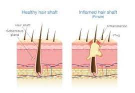 how to stimulate hair follicles hair