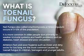 toenail fungus symptoms causes and
