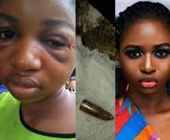 lady survives 5 days with bullet in her