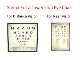 Overview Of Low Vision Examinations Ppt Video Online Download