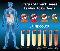 free vector ses of liver disease
