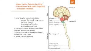 upper motor neuron weakness utilizing