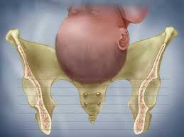 Fetal Descent Birth Station Progress Dilation