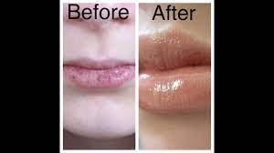 how to get smooth and soft lips you