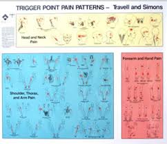 Travell And Simons Trigger Point Chart 1 Www