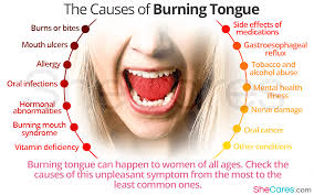 causes of burning tongue most common