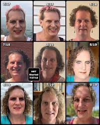 Mtf transition timeline with hrt over 2 years. Mtf 48 Yo 13 Months Of Hrt Timeline Photo Translater