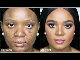 properly conceal your acne dark spots