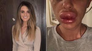 balloon after botox injection