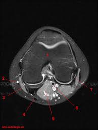 These are essential structures to evaluate in routine assessment of the knee on mri. Atlas Of Knee Mri Anatomy W Radiology