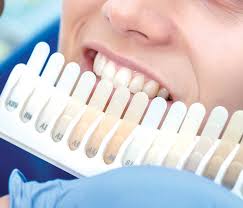 Tooth Whitening Princes Street Dentist