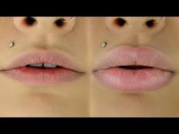 how to get big huge lips without