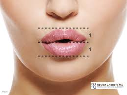 the ideal lip shape in plastic surgery