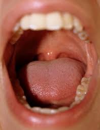 is your mouth sore common or something