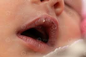 newborn baby with dry lips 26760743