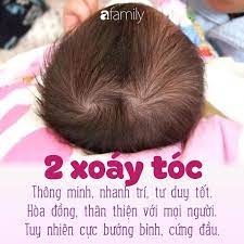 aFamily.vn - Vui vui về hai xoáy tóc Những người có hai xoáy tóc thường ít  gặp. Nhân tướng học đánh giá đây là những người thông minh, nhanh trí, nhớ  nhanh,