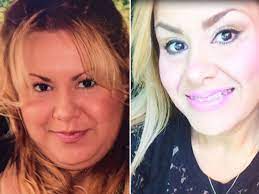 How much is chin lipo uk. The Woman Who Lost Her Double Chin In One Hour Thanks To Lunch Hour Liposuction Mirror Online