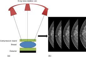 Principles Of Digital Breast Tomosynthesis A Tube Rotations