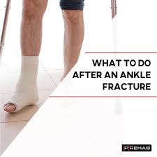 an ankle fracture with exercise