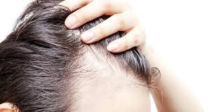 led light hair loss therapy revive clinic