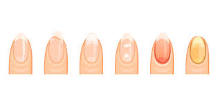 What Your Nails Reveal About Your Inner Nutrition Status