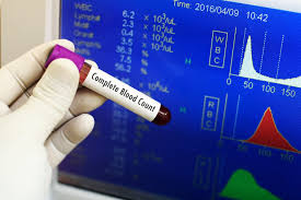 What Is A Complete Blood Test Understanding Its Importance