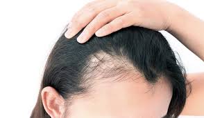 find the best hair transplant clinic in