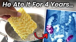 a boy ate instant noodles for 4 years