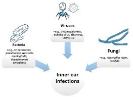 treatment of inner ear infections