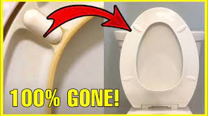 remove yellow stains from toilet seat