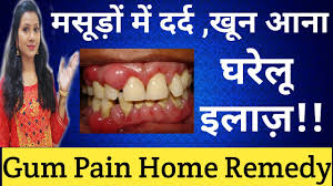 इल ज bleeding gums home remedy