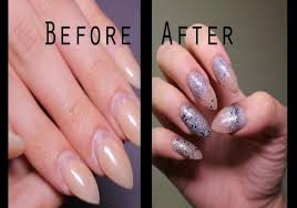which is better gel or acrylic