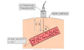 Doppler Effect In Ultrasound 6 13 5